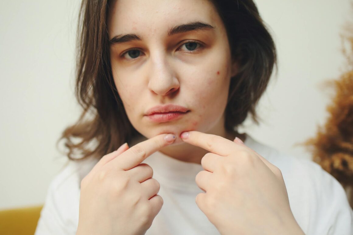 a woman popping a pimple